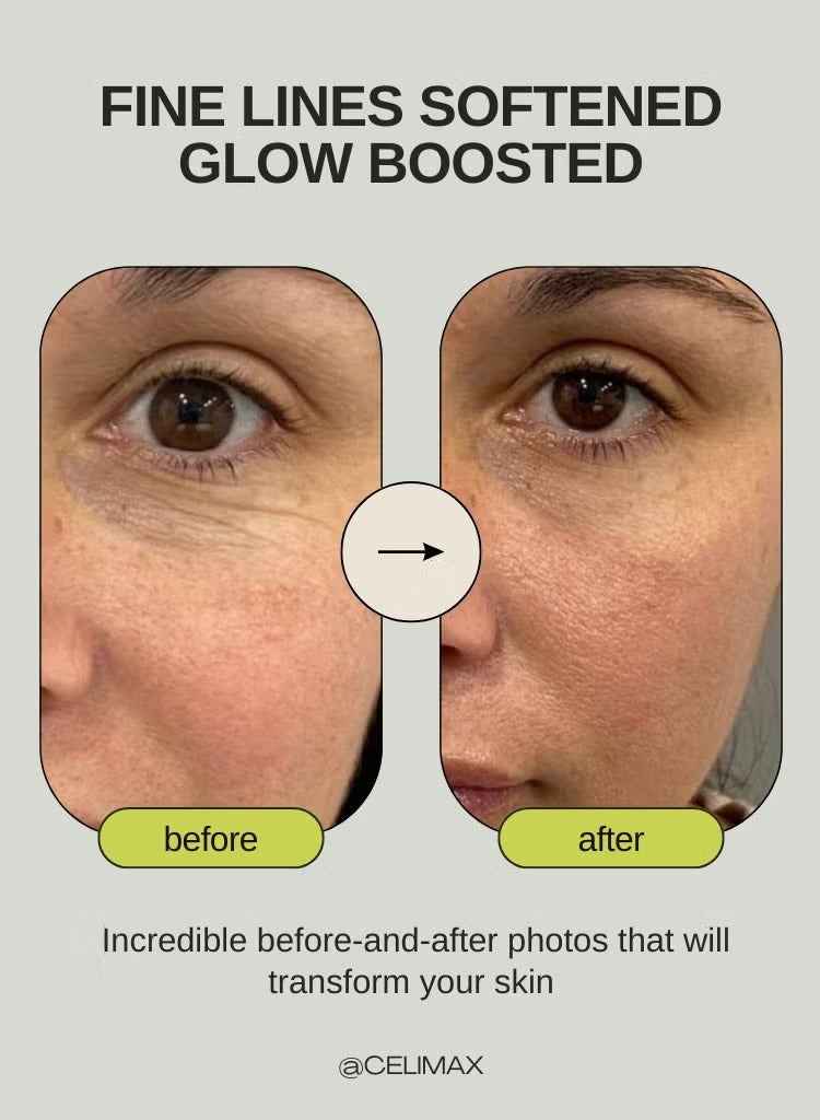 Retinal Shot Tightening Booster